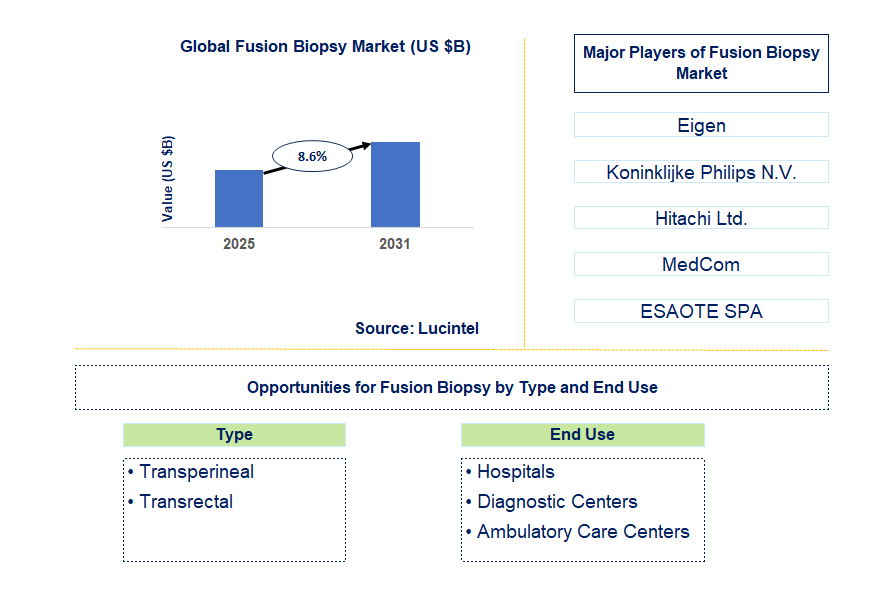 Fusion Biopsy Market Trends and Forecast