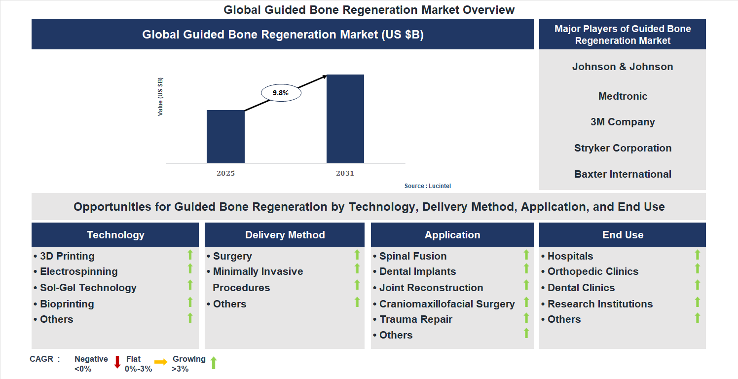 Guided Bone Regeneration Market Trends and Forecast